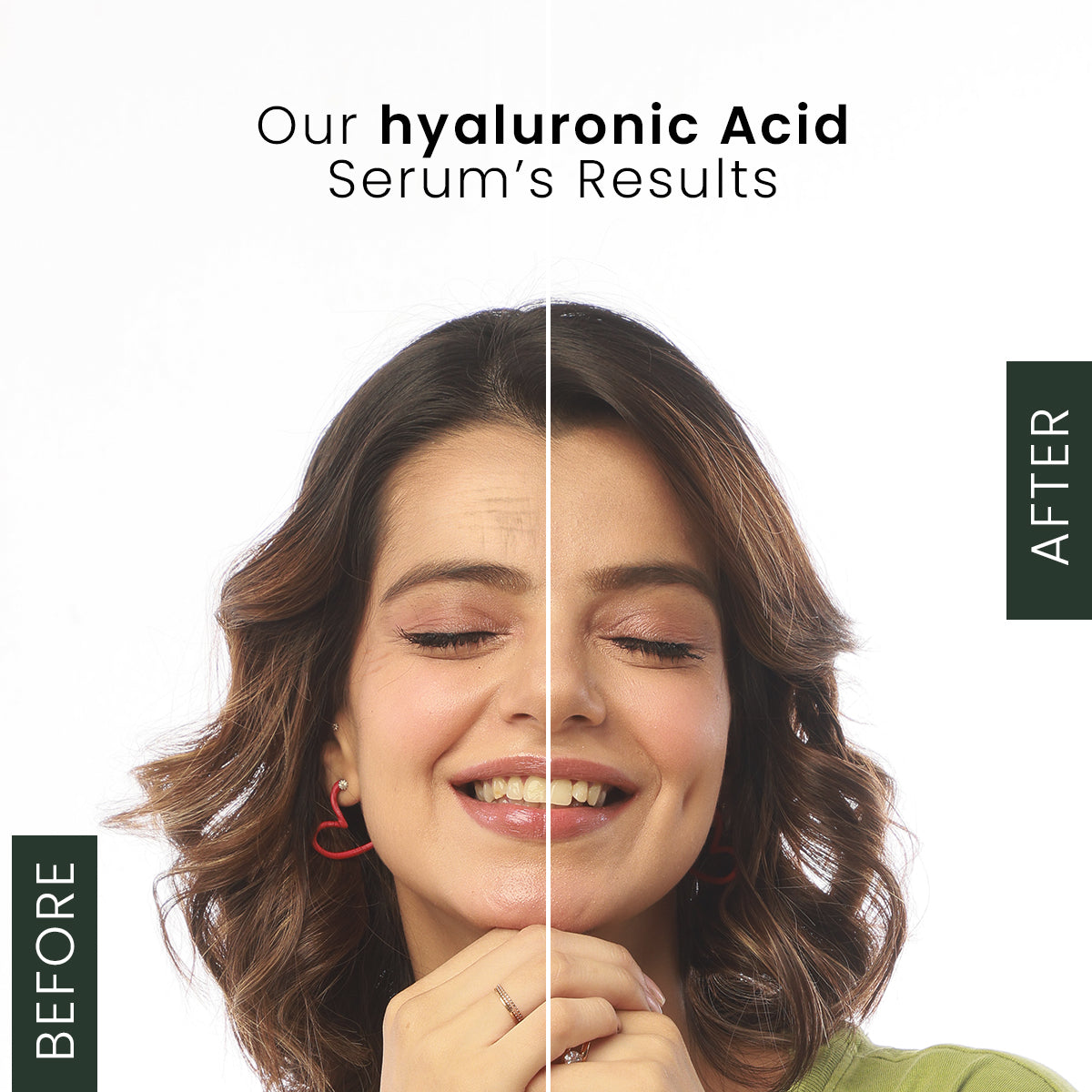 Hyaluronic Acid 30ML