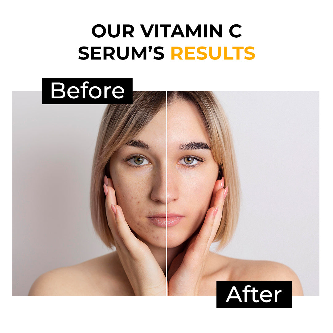 Vitamin C Serum 30ML